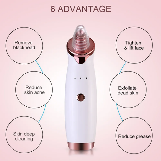 Electric Blackhead Remover